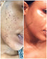 Dark Spot Corrector Cream - Abinna Cosmetics